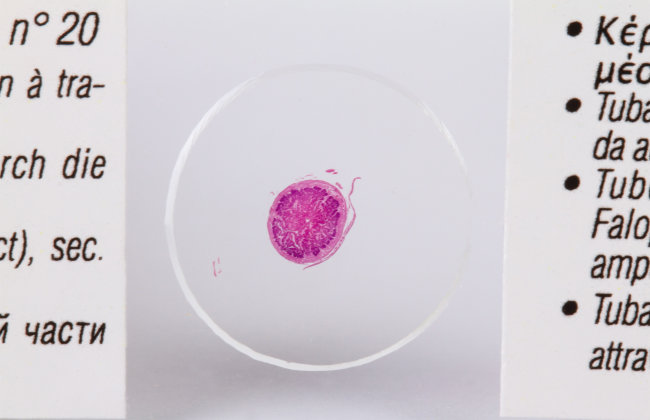 Набор микропрепаратов Konus 25: «Человеческое тело»