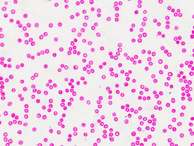 Набор микропрепаратов Bresser «Гистология», 30 шт., в кейсе Набор микропрепаратов Bresser «Гистология», 30 шт., в кейсе