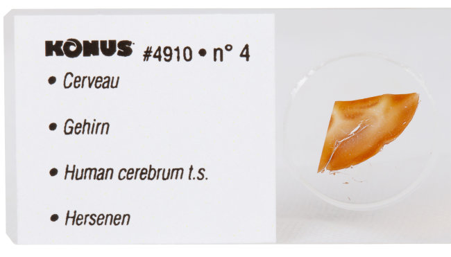 Набор микропрепаратов Konus 10: «Человеческое тело. Норма» Набор микропрепаратов Konus 10: «Человеческое тело. Норма»