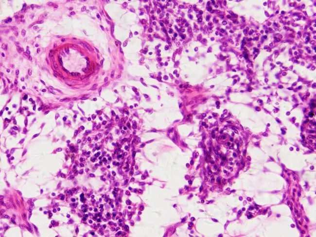 Набор микропрепаратов Bresser «Гистология», 30 шт., в кейсе