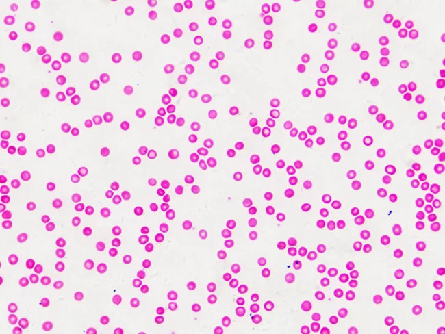 Набор микропрепаратов Bresser «Гистология», 30 шт., в кейсе